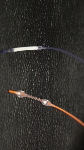 #Coronary #stent #design & #technology [Ref: Abbott laboratories] #medical #biotechnology #heart #biomaterials #mechanical #engineering #LearnOnTikTok