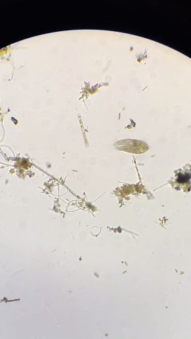 What’s Hiding Under the Microscope? Exploring the Tiny World