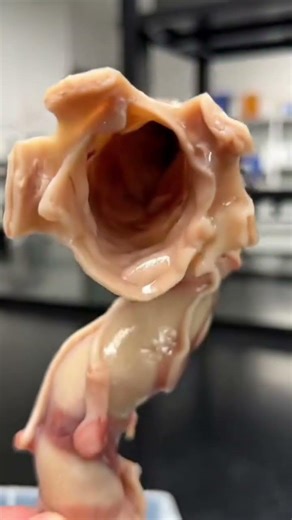 Trachea (Windpipe) Explained | How Your Airway Works