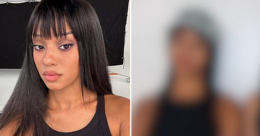 KATSEYE Manon's "Change" In Appearance Leads To Lip Filler Accusations