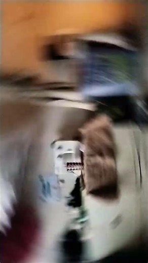 my arm broke. #arm #hospitle #360trend