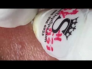 huong spa acne treatment huong official