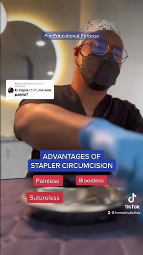 Advantages of Stapler Circumcision