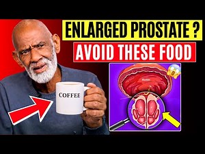 Over 50? This Common Food Is Destroying Your Prostate (Dr. Sebi Explained)