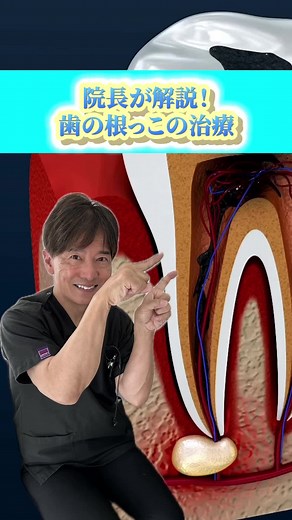 歯の根っこの治療についての解説