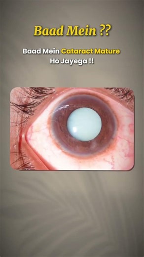 Blurred Vision? Don’t Ignore It! It Could Be Cataract | 15-Minute Treatment Explained