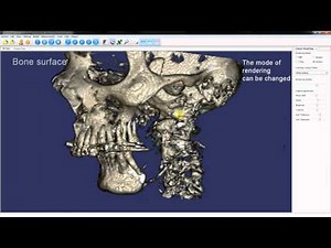 3DimViewer: Chapter 5 Volume rendering