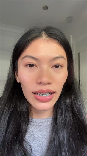 Teeth Movement Post-Braces: Observations and Concerns