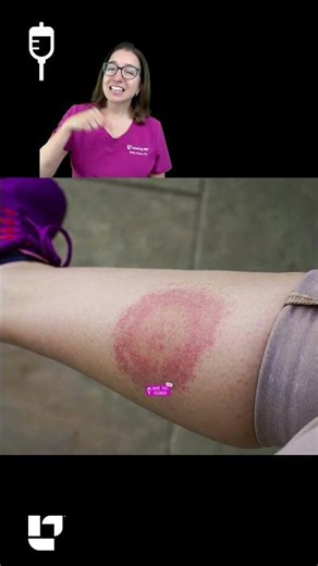 ⚕️ Name this disorder! #95: Medical Surgical SHORT | ‪@LevelUpRN‬