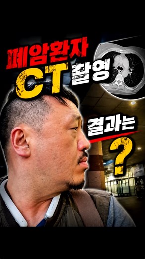 폐암4기 암환자는 이번달은 두번 '분당서울대병원' 에 갑니다. #폐암4기#타그리소#표적치료제#항암주사#폐암말기#폐암증상#폐암4기증상#항암부작용#폐암치료제#폐암환자 @80