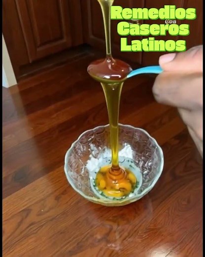 “Aceite de Oliva, Bicarbonato, Miel y Limón: Remedio Casero Popular y Para Qué Se Usa”