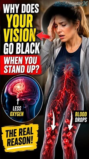 🧠 Why Does Your Vision Go Black When You Stand Up? #medicalfacts #science #medanimatorx #healthfacts