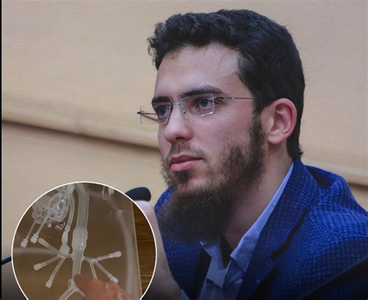 بالفيديو.. دكتور مغربي يبتكر جهازا ثوريا لتصفية الدم داخل الأوعية الدموية – الشروق أونلاين