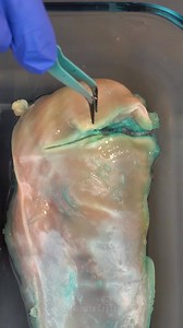 What Happens to Skin After Different Detergents | 5-Minute Crafts