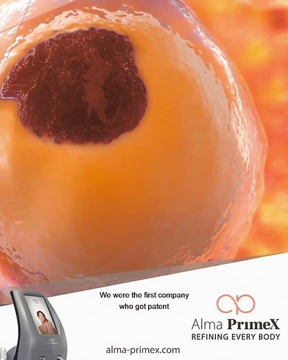 The technology behind Alma PrimeX - the non-invasive platform for body contouring & skin tightening