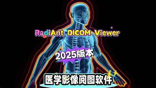 RadiAnt DICOM Viewer2025医学影像阅图软件
