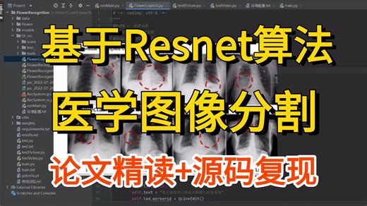 强推！基于Resnet算法的医学图像分类实战！论文解读+项目实战+源码复现，全程干货，比刷剧还爽！AI/深度学习/AI医疗/论文创新点/计算机视觉