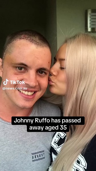 The Aussie actor and singer suffered a long battle with terminal brain cancer 🖤 #johnnyruffo #rip #homeandaway #xfactor #braincancer