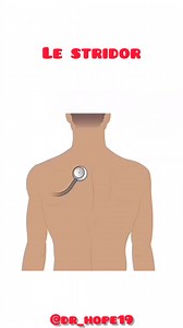 Les bruits respiratoires🩺 : le stridor ✅ . . . . . . . . . . ____________________________________ #pneumo #pneumologie #pneumologue #radio #scanner #hope #study #medecine #medstudent #students #hospital #hopital #algeria #dz #ziania #doctors #residentlife #طبيب #طب #studing #instagram #doctors #reels #instagood #bruits #residentlife #lungs #stridor | Dr hope