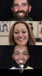 14 reactions | Before and After transformations that have us BLOWN AWAY! We could not be happier with these incredible smiles, and we are so proud of our work. #beforeandafter #beforeafter #newsmile #newsmilenewlife #dentalveneers #smiledesign #smiledesigner #brigherimagelab #whiteteeth #smilemakeover #smiletransformation #cosmeticdentistry #nodentist #creatingsmiles #veneers | Press On Veneers by Brighter Image Lab | Facebook