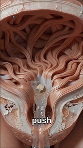 Inside Your Body The Painful Journey of a Kidney Stone Visual Study #kidney