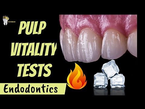 ENDODONTICS | PULP VITALITY TESTS MADE EASY !!!