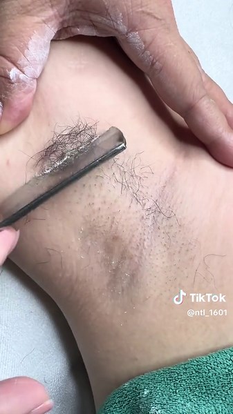 “Triệt lông nách không chỉ đẹp mà còn… sạch! Giảm tích tụ mồ hôi, hạn chế mùi cơ thể ” 🙆‍♀️ #hoangmaibeautyacademy #trietlonglanhhieuquadanang #trietlongdiodelaser #trietlongnach