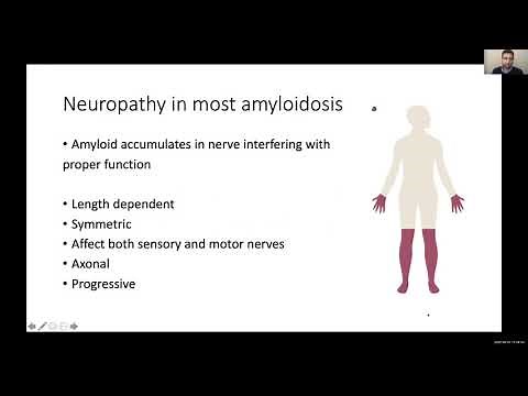 Peripheral and Autonomic Neuropathy in ATTR Amyloidosis