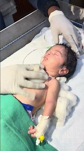 Chestryped being for newborn baby☺️ #sumitnicunursingstm #youtubeshorts #newbornbaby #chestworkout