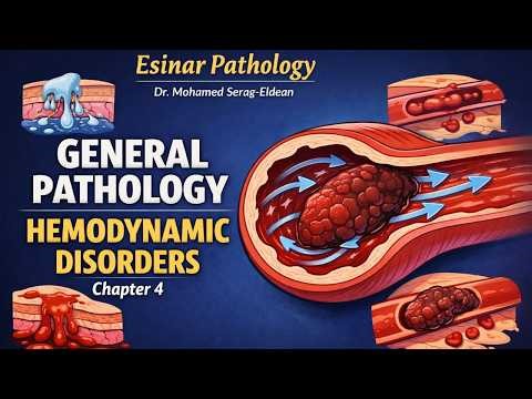 Hemodynamic disorders | 1- Edema