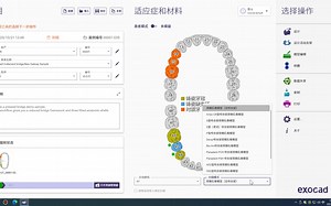 Exocad DentalCAD数字化牙科CAD CAM软件Exocad-3.0 7754 (1)
