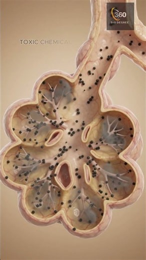 What Happens When You Smoke a Cigarette? 🚬 | Lungs to Bloodstream | 3D Anatomy
