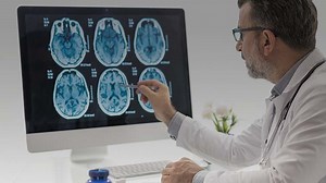 Alzheimer’s Disease: What’s The Latest Research?