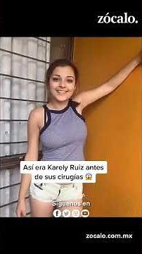 Así era Karely Ruíz antes de sus cirugías