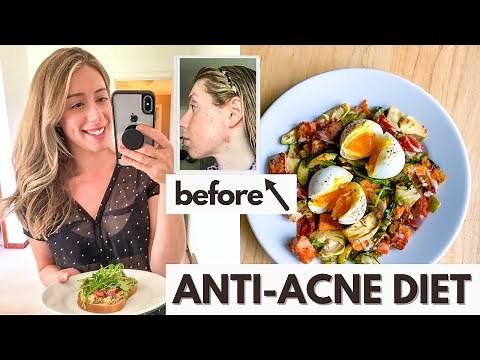 Anti-Acne Diet: What I Eat in a Day for Hormonal Acne