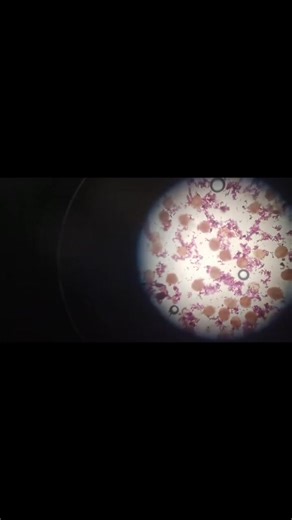 1.2K views · 31 reactions | Doing a PBG experiment and observing chromosomes under the microscope… they really look like they’re having a family meeting to decide who gets the dominant genes! 溺 | Kamil Buzdar | Facebook