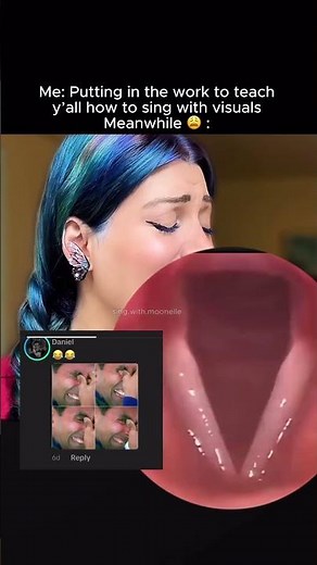 What do vocal cords look like? ￼