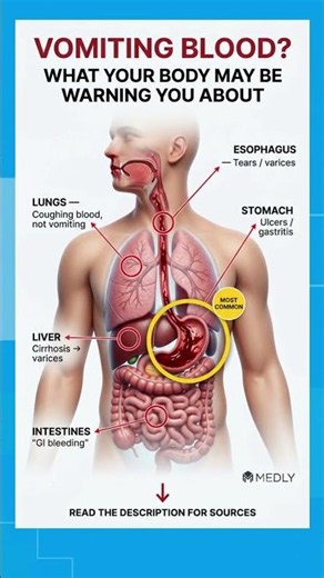 DIFFERENT TYPES BLOODY VOMITING!🚨MOST IMPORTANT ONE!