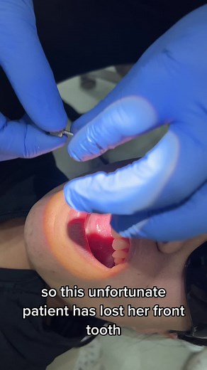 faceteethsmile on TikTok