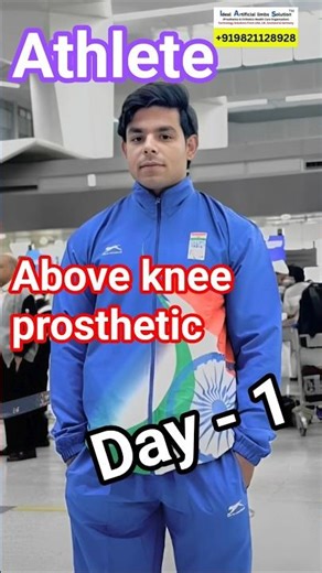 Above Knee prosthetic | Ossur | Artificial Leg Price in India | Jaipur Foot #bestclinic #ossur #3r80