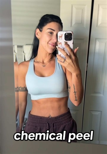 using the 40% lactic acid peel this week. these are great weekly peels to use between microneedling sessions. i also use mandelic acid peels and spot treat with salycitic acid. #skincare #skincareroutine #chemicalpeel #lacticacid #acne