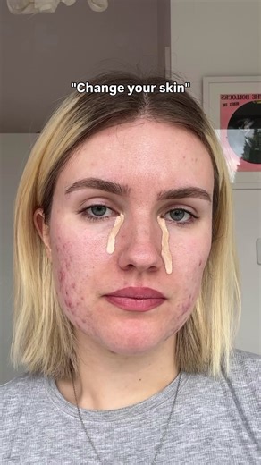 It broke my heart watching this back. I had no idea just how many documentary photos I had taken of my skin over the years. You can see how long and desperately I wanted