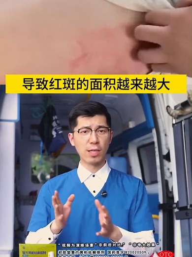 天然中藥精華：複方黃柏祛癬噴劑
