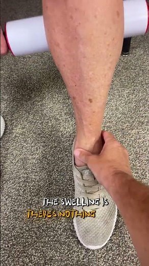 Rolling pin massage to calf after Total Knee Replacement