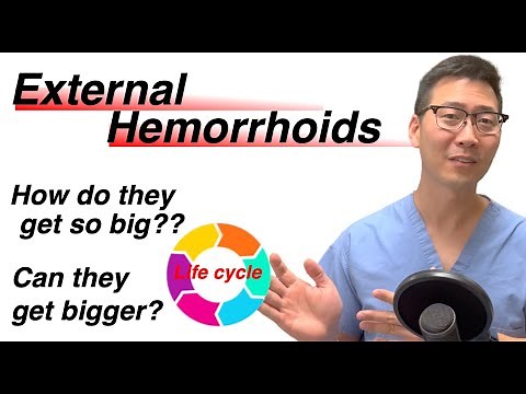 Life cycle of External Hemorrhoids! From baby to adult. | Dr. Chung explains!