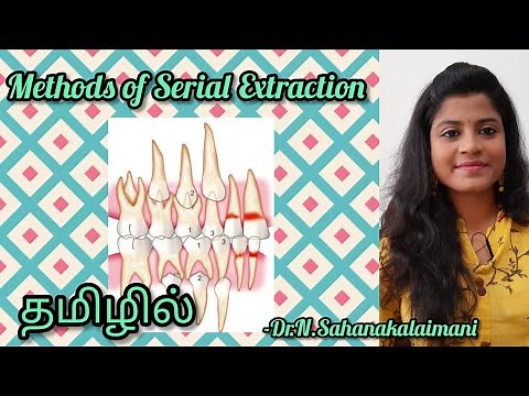 Methods of Serial Extraction Explained In Simple Words| Dewels method| Tweeds and Nance method|tamil
