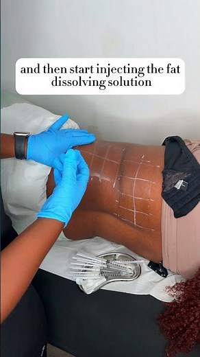 Fat Dissolving Injections | How It’s Done | #FatDissolving | How To Reduce Stubborn Fat