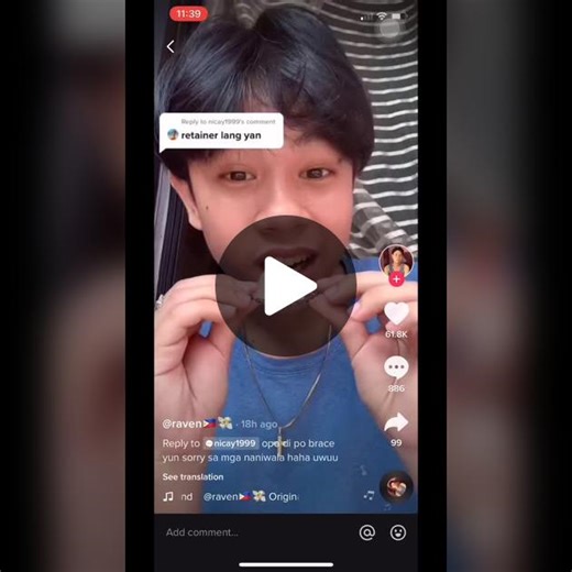 Retainer Like Braces: Are They Worth It?