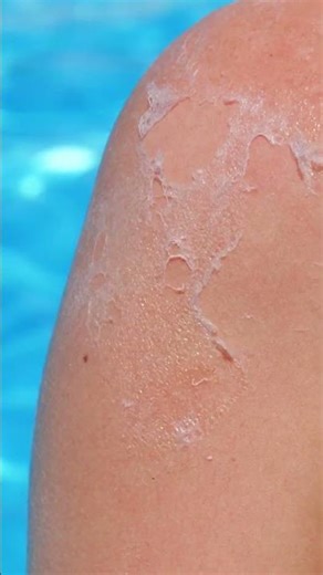 Epic Beach Hacks You Never Knew You Needed! 🏖️✨