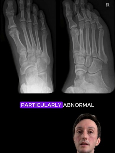 Radiopaedia on TikTok